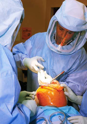 Knee Replacement