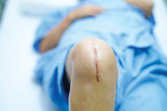 Wound Care