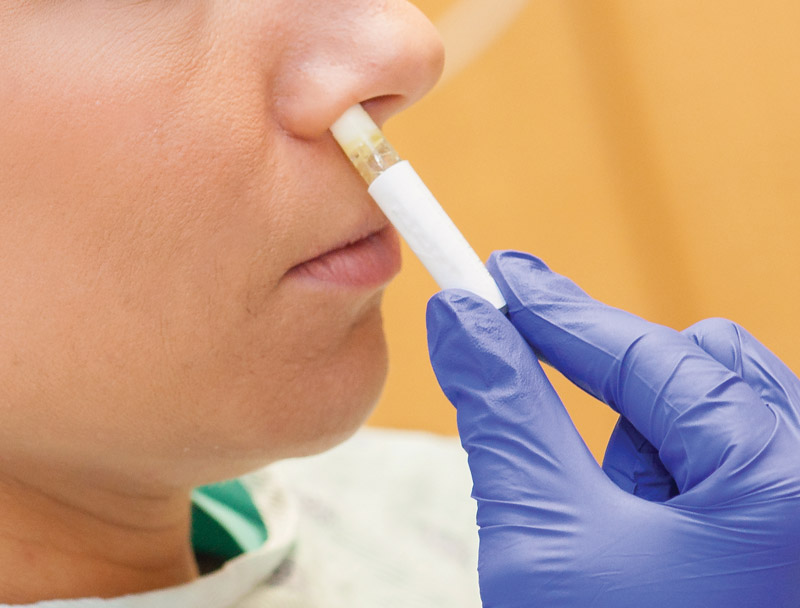 Mrsa Infection In Nose