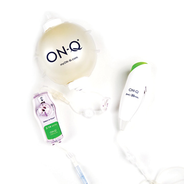 A Pain Pump Patients Can Customiz\e