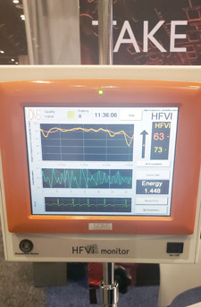 HFVI\ Monitor