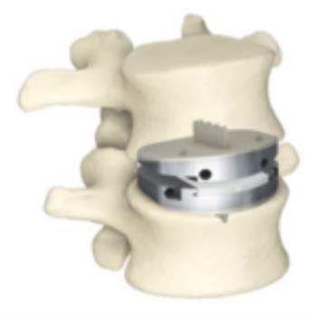 centinelspine.com