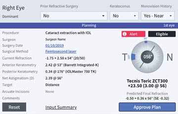 Cataract Surgery Efficie\ncy