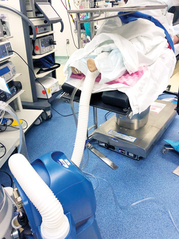 LOW INFECTION RATES