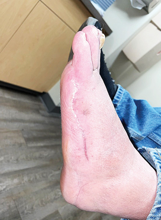 post-amp-healed