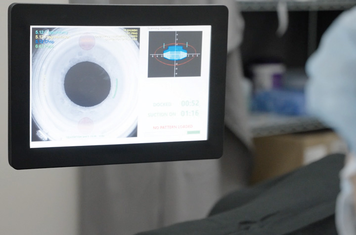 July25Cataract-Screen-View-Dr Cataract-Screen-View