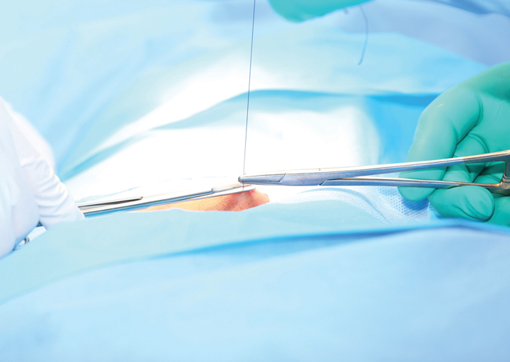Wound Care